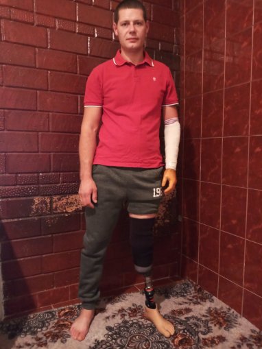 Another dream came true, another destiny was changed. Igor Dunasi received the prosthesis he had dreamed of for a long time and waited for many years!